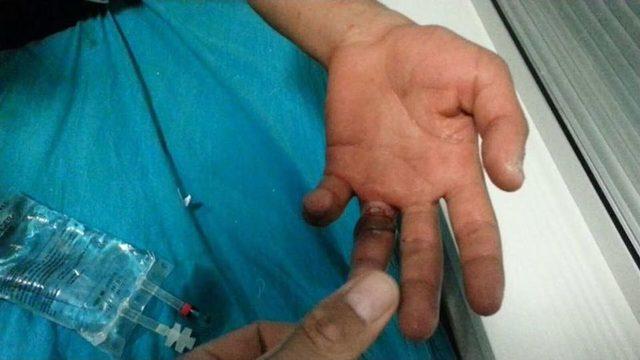 Van&rsquo;da Parmağına Y&uuml;z&uuml;k Sıkışan Gencin İmdadına Afad Ekipleri Yetişti 2