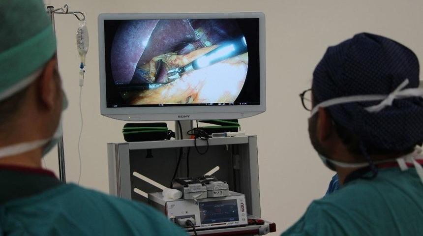 İleri Laparoskopik Cerrahi İle Refl&uuml; Tedavisi