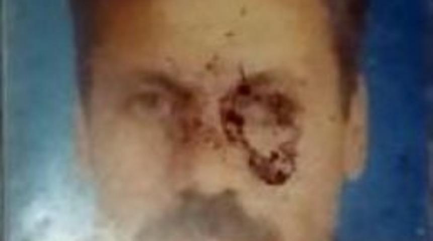 Kavşakta Otomobilin &Ccedil;arptığı Motosikletli &Ouml;ld&uuml;