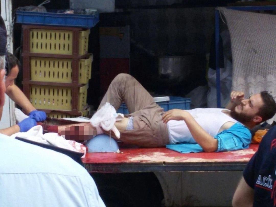 Pazar Yerinde K&ouml;fteciyi Vurup Rastgele Ateş A&ccedil;tılar: 4 Yaralı