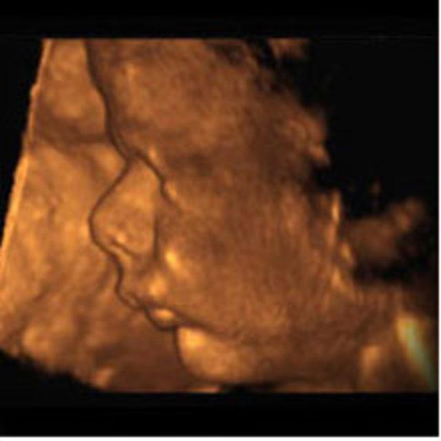 Малыш на 37 неделе. УЗИ плода на 23 неделе беременности. Снимки УЗИ на 23 неделе беременности. Снимок УЗИ на 23 неделе беременности.