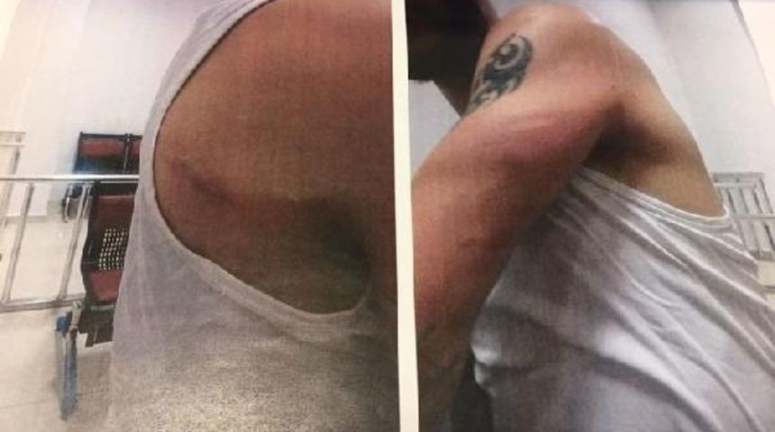 "&ccedil;iğ K&ouml;fteli" Haraca 15 Yıl Hapis Istemi