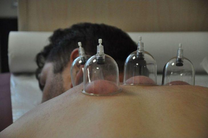 Devlet Hastanesinde Hacamat Ve Akupunktur Polikliniği Açıldı G2