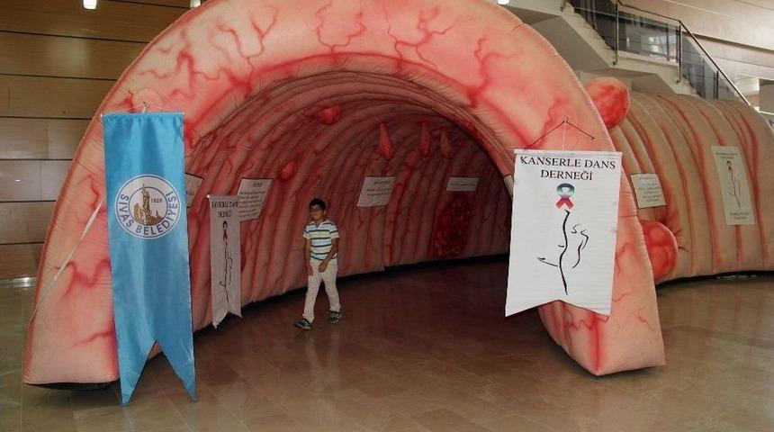 Dev Kalın Bağırsak Maketiyle Vatandaşlar Bilgilendirildi