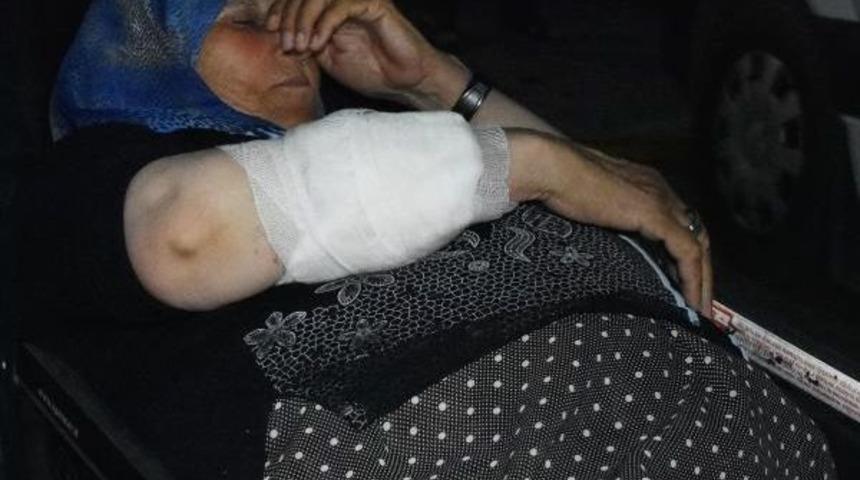 Suriyeli Kadın, Evinin &Ouml;n&uuml;nde Otururken Kolundan Vuruldu