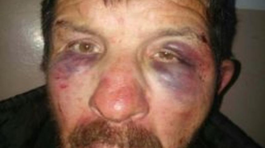 12 Yaşındaki &Ccedil;ocuğa Tecav&uuml;z Ş&uuml;phelisine Dayak