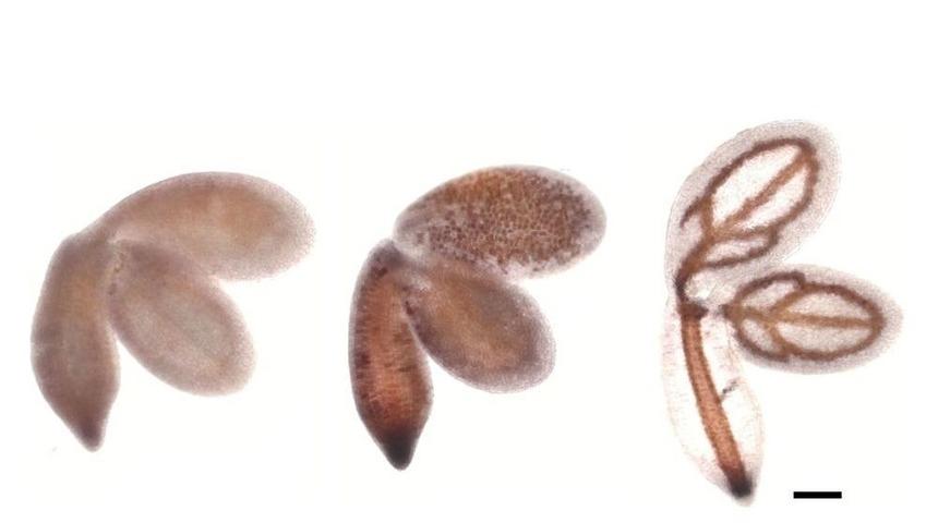 Bitkilerdeki Demir Miktarını Belirleyen Yeni Gen Keşfedildi