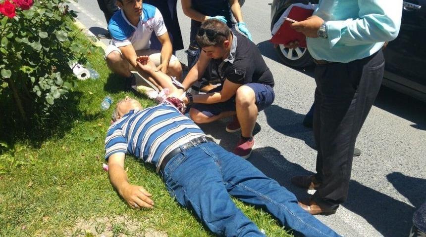 Yolun Karşısına Ge&ccedil;mek İsterken Otomobil &Ccedil;arptı