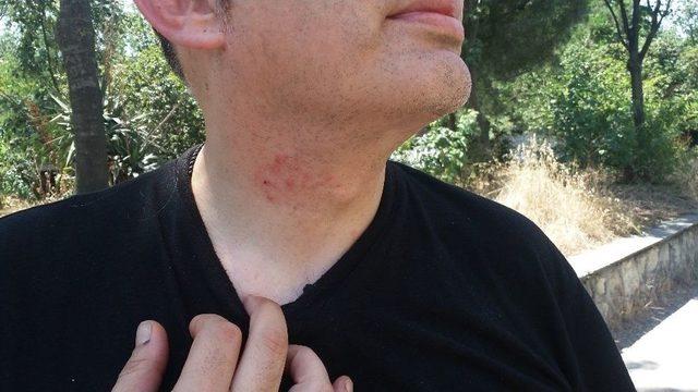 Boğazına Bı&ccedil;ak Dayanan Doktor O Anları Anlattı 1