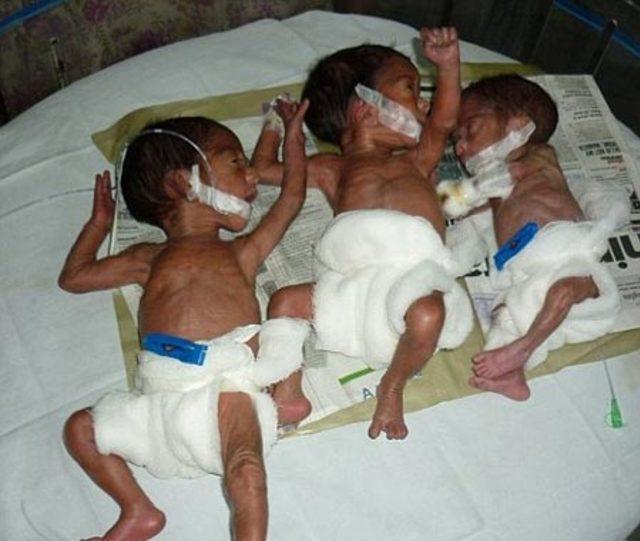 Dünyanın En Yaşlı Üçüz Annesi 1