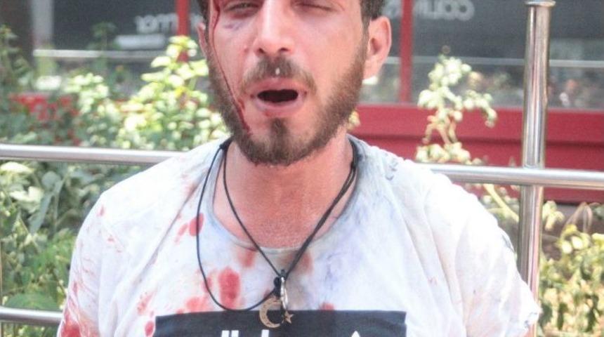 Seyyar Satıcılarla Zabıtalar Birbirine Girdi