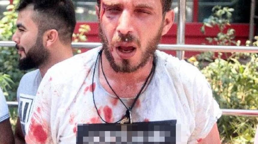 Seyyar Satıcılarla Zabıtalar Kavga Etti: 2 Yaralı