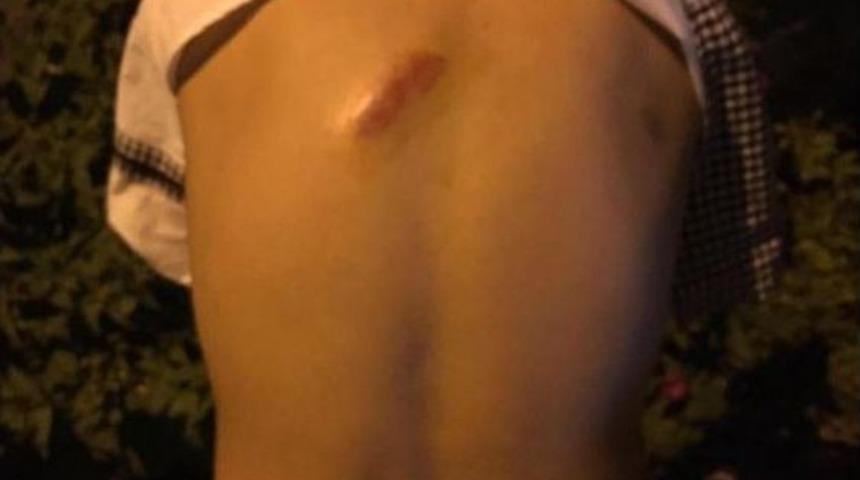 Ala&ccedil;atı'daki Kavgada Fatih Terim Ve Damatları Karakolluk Oldu