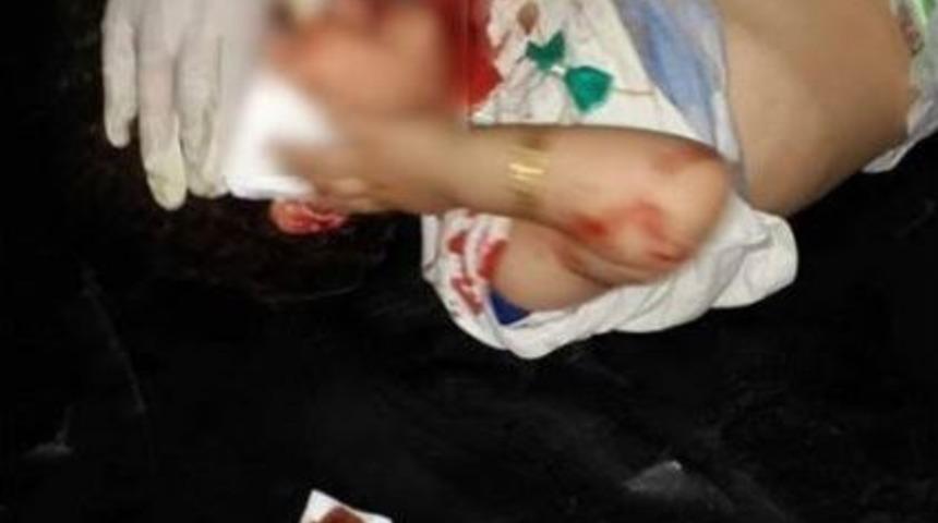 Tsk&rsquo;dan &rsquo;ter&ouml;r &Ouml;rg&uuml;t&uuml; Pyd/ypg&rsquo;nin Suriye Saldırılarına&rsquo; İlişkin A&ccedil;ıklama