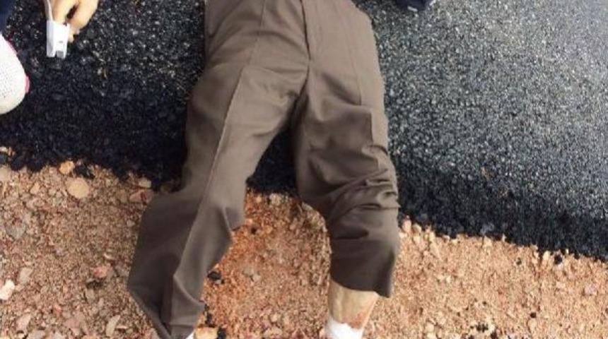 Yol Kenarında Ayak Bileklerinde Bı&ccedil;ak Yarasıyla Bulundu, Hastanede &Ouml;ld&uuml;