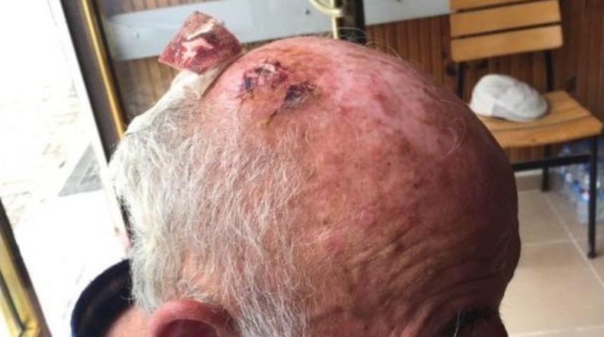 Yumurta Büyüklüğündeki Dolu, Taksicinin Başını Yardı