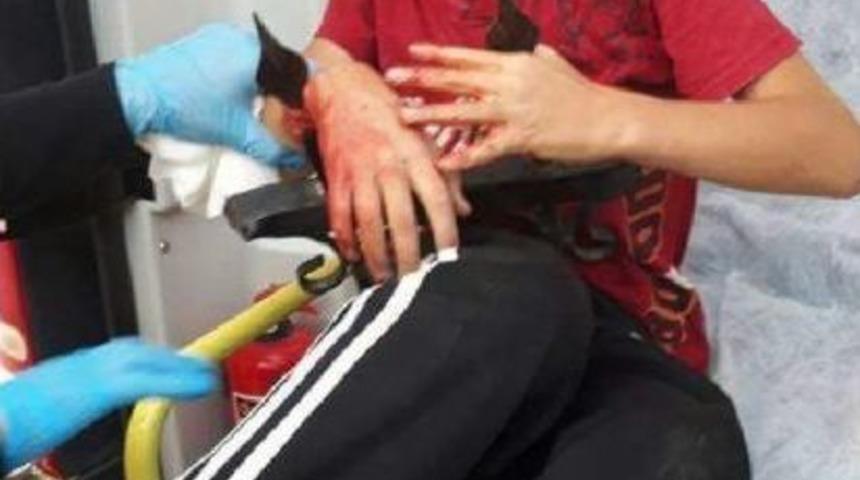 Korkuluklardan Atlayan &Ccedil;ocuğun Koluna Demir Saplandı