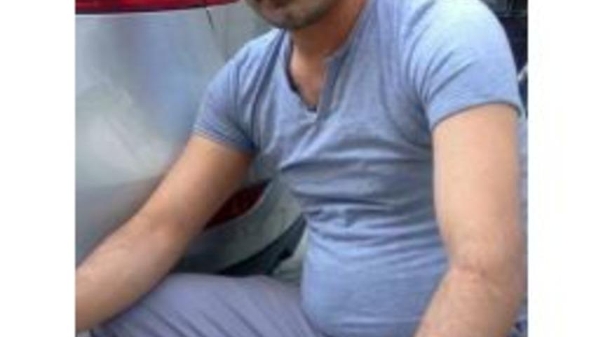 Odunla Kafasına Vurulan Şahıs &Ouml;ld&uuml;