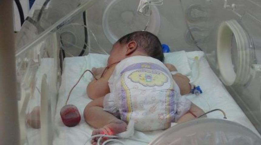 Y&uuml;ksekova&rsquo;Da 3 Saatlik Bebeğe Omirilik Ameliyatı Yapıldı