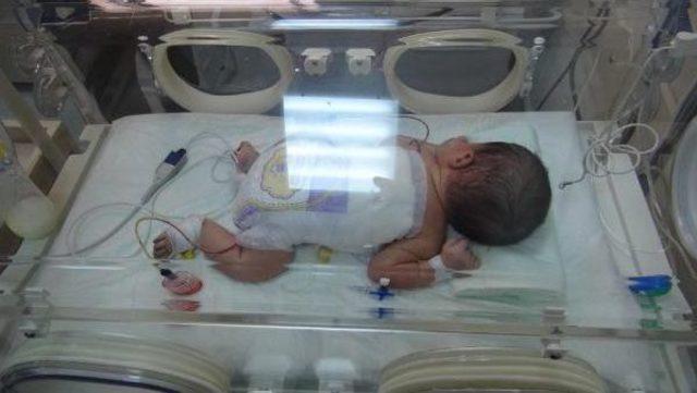 Yüksekova’Da 3 Saatlik Bebeğe Omirilik Ameliyatı Yapıldı
