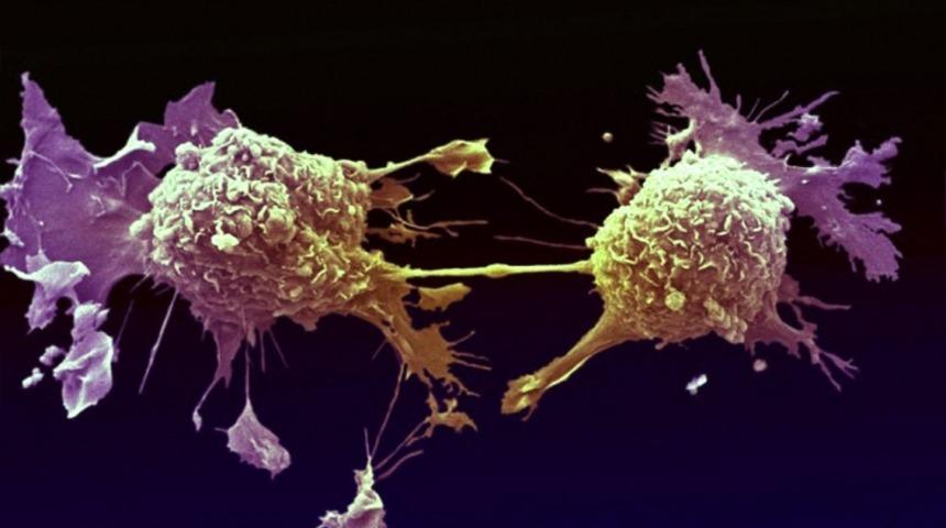 Kanser H&uuml;crelerini Yok Etmede Etkisi Kanıtlanmış 10 Yiyecek