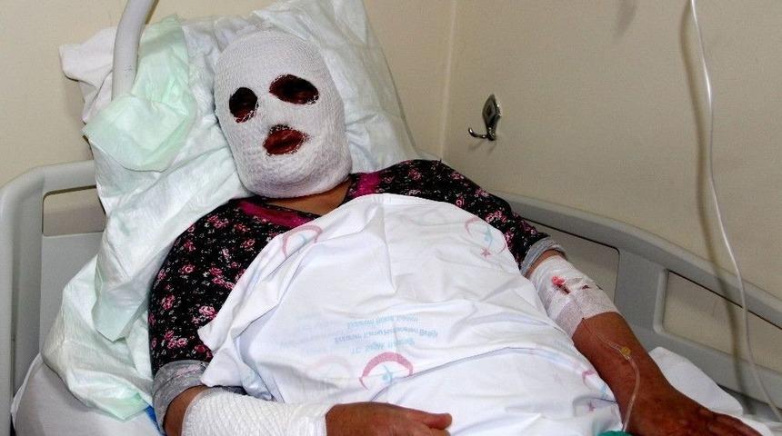 Temizlik Yaparken Dikkatsizlik Kadını Bu Hale Getirdi