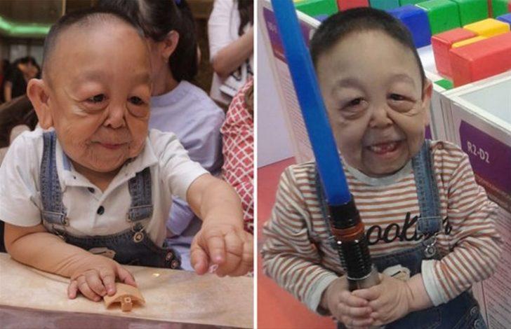 Beyni dışarıda doğdu! Şimdi ise...  G4