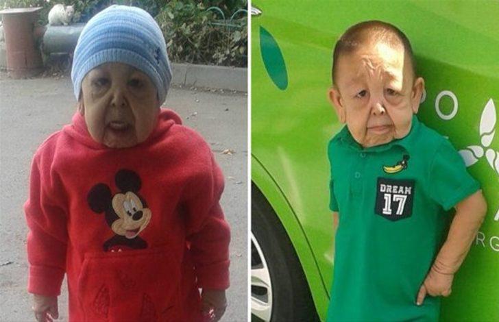 Beyni dışarıda doğdu! Şimdi ise...  G5