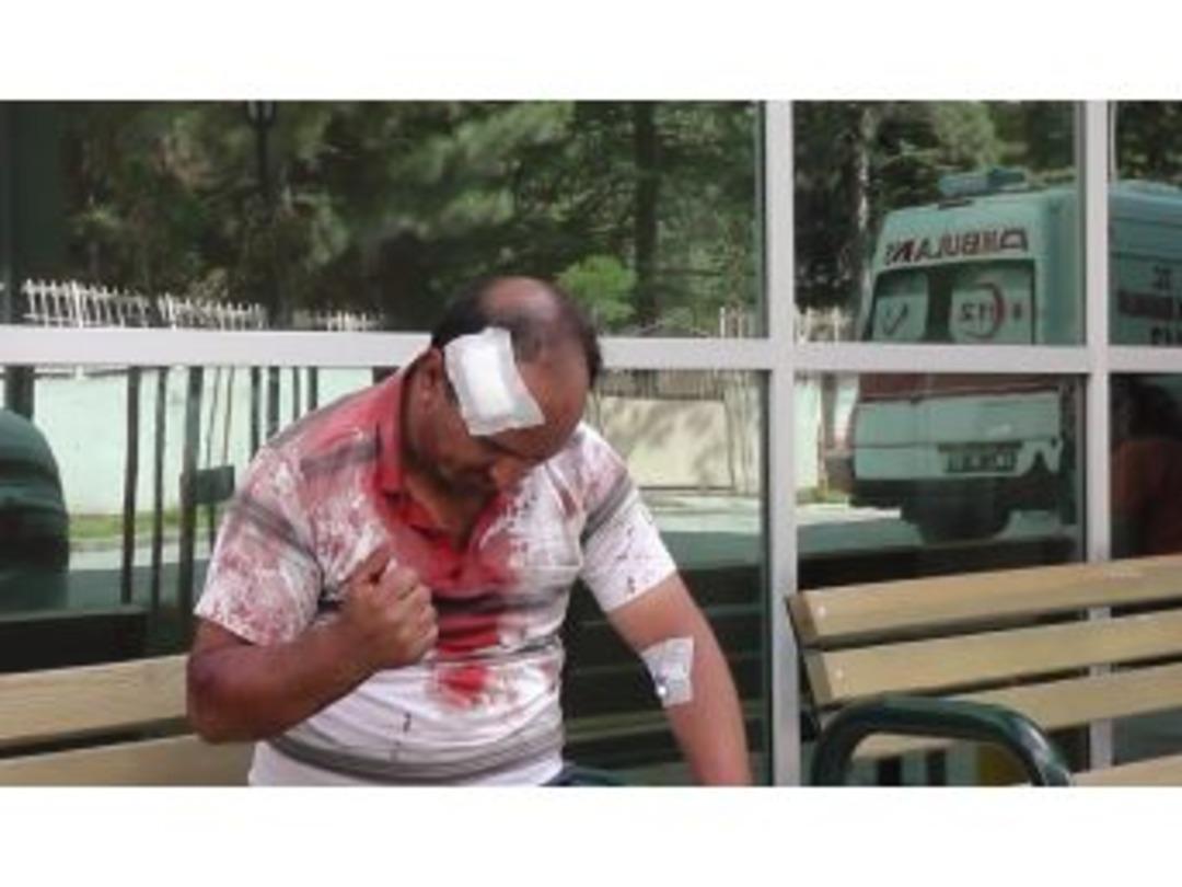 Kavgada Başından Bıçaklandı