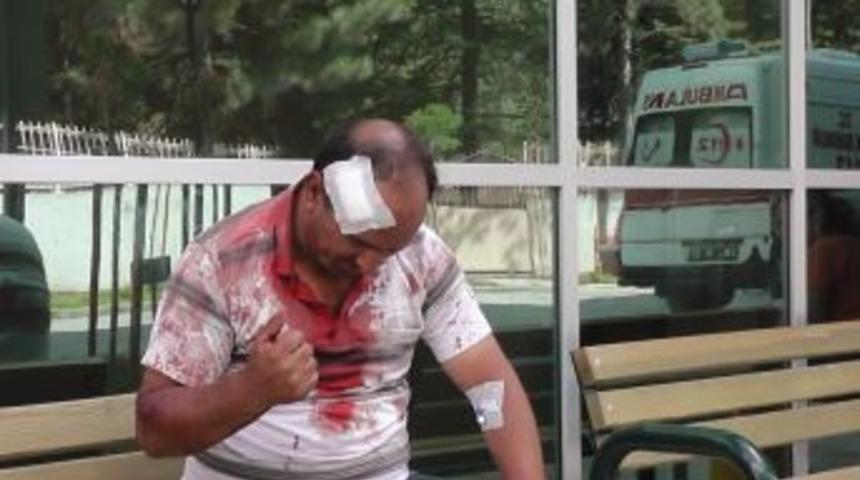 Kavgada Başından Bı&ccedil;aklandı