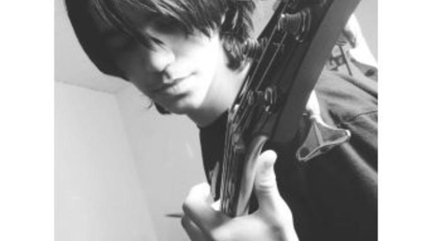 Roket Yaparken 2 Eliyle G&ouml;z&uuml;n&uuml; Kaybeden Altuğ, Yarın Taburcu Oluyor