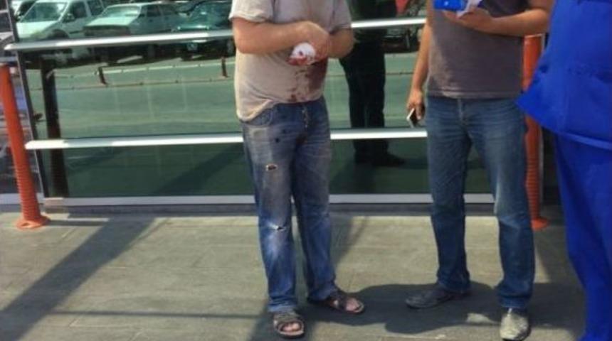 İş Kazasında Parmağını Kaybetti