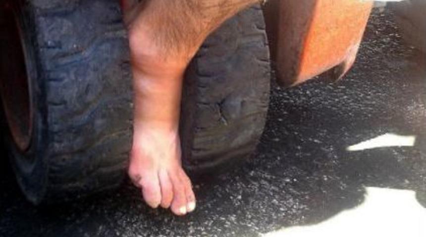 Forkliftin Tekerlerine Sıkışan Ayağı Kırıldı