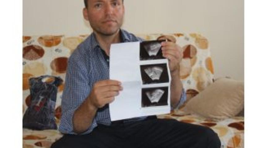 &Ouml;nce Babasını, Ardından Babasından Nakil Aldığı B&ouml;breğini Kaybetti