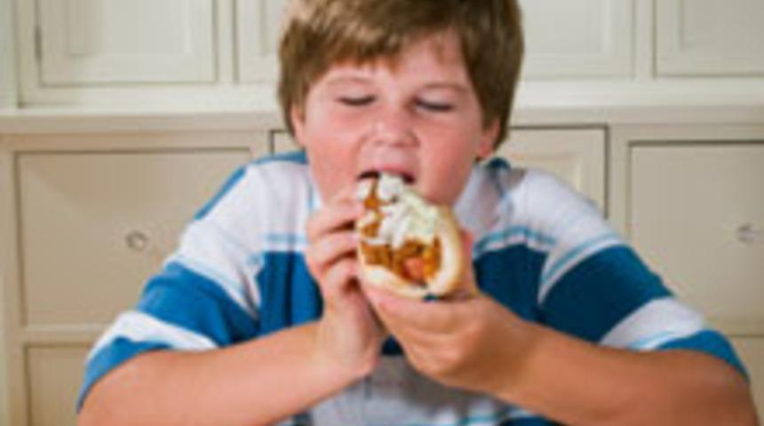 Şişman &Ccedil;ocuklarda Taş Riski