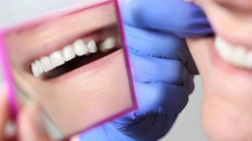 Diş Çekmek Yerine Kanal Tedavisi