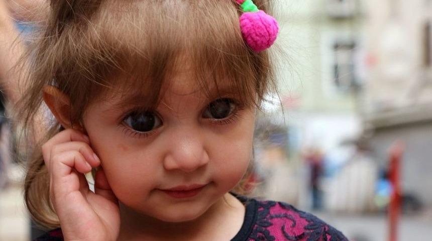 Sol G&ouml;z&uuml;n&uuml; Tamamen Kaybetme Riski Olan Simay Bebek Yardım Eli Bekliyor