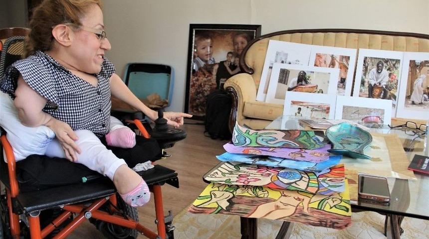 (&ouml;zel Haber) Cam Kemik Hastası Kadının On Parmağında On Marifet