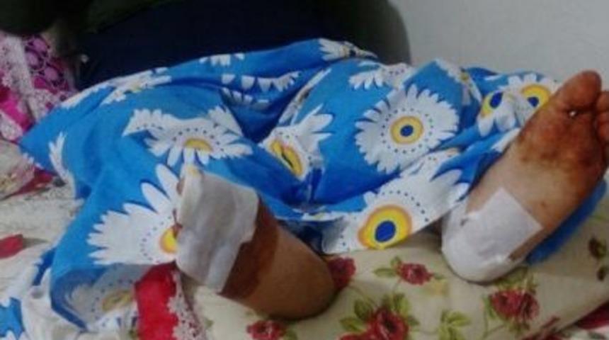 10 &Ccedil;ocuk Annesi Yıkılan Merdivenin Altında Kaldı