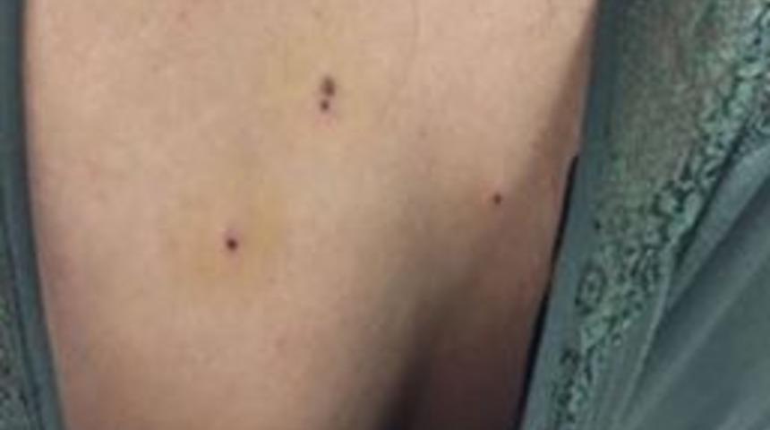 Kına Eğlencesinde Maganda Dehşeti: 10 Yaralı