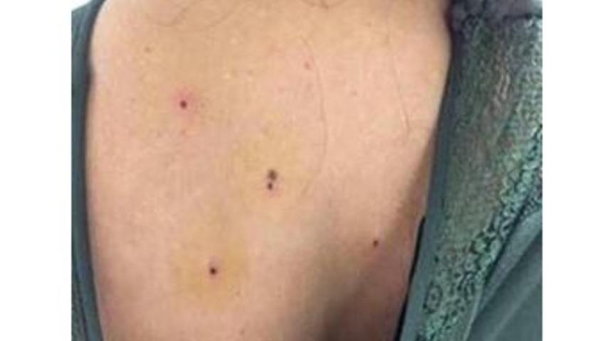 Kına Eğlencesinde Mlaganda Kurşunu: 4 Yaralı