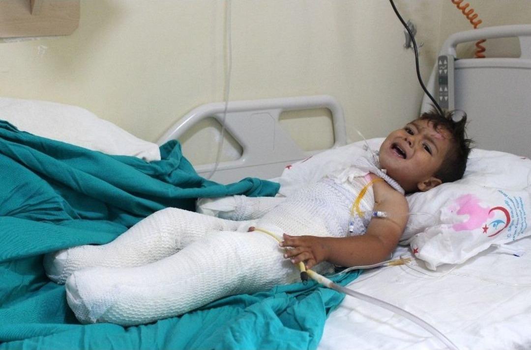 Tandıra D&uuml;şen 2 Yaşındaki &Ccedil;ocuk Feci Şekilde Yandı