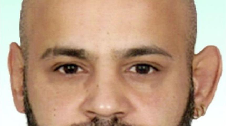 Sahte Estetik&ccedil;i Cezaevinden Ka&ccedil;tı