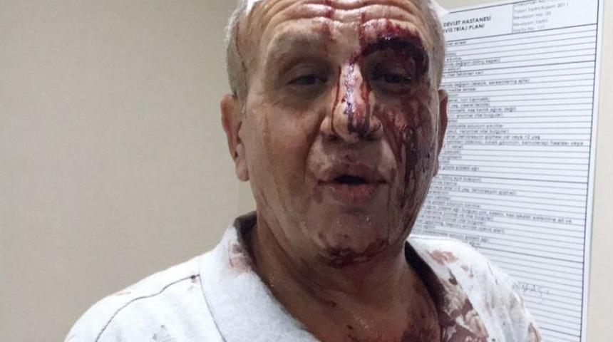 Ağabey-kardeş Arasındaki Arsa Kavgası Kanlı Bitti: 5 Yaralı