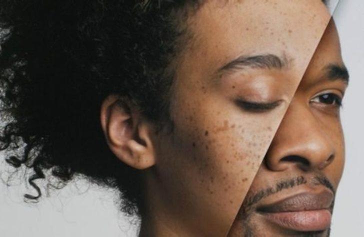 Neden Kadınlar Erkeklerden Uzun Yaşar?