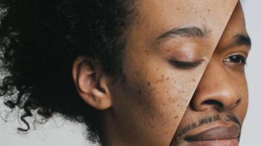 Neden Kadınlar Erkeklerden Uzun Yaşar?