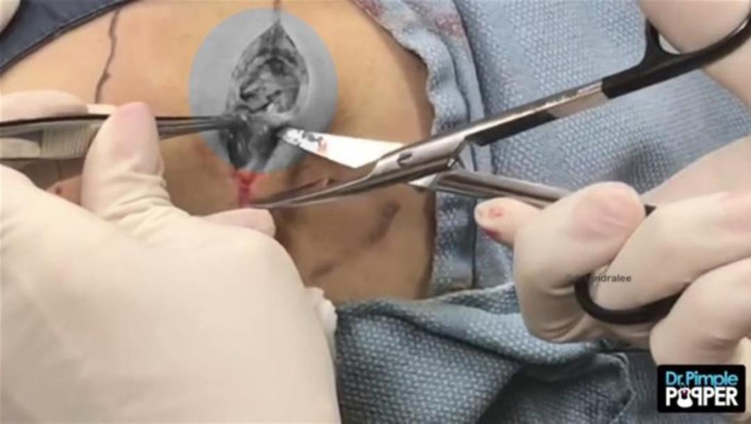 Kal&ccedil;asından &ccedil;ıkanlar şoke etti 