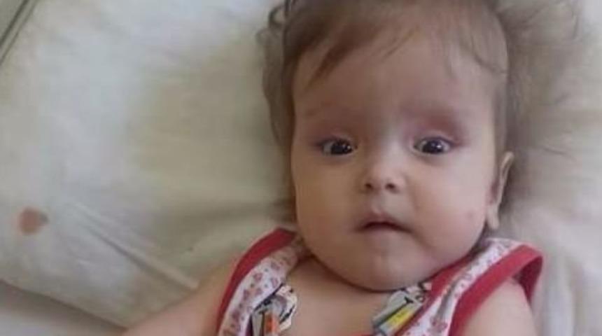 11 Aylık S&uuml;meyye&rsquo;nin Yaşı K&uuml;&ccedil;&uuml;k Derdi B&uuml;y&uuml;k