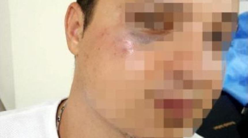 Hasta Almaya Giden 112 Ekibine Saldıran 3 Ş&uuml;pheli G&ouml;zaltına Alındı