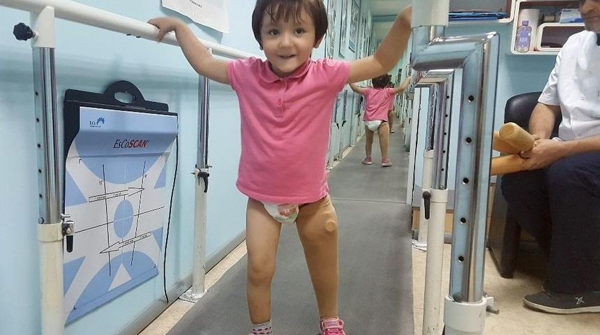 Minik &Ouml;zge Yeni Protezine Kavuştu